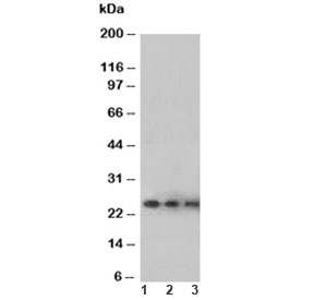 VEGFA / VEGF Antibody - Western blot testing of VEGF antibody and Lane 1: Recombinant human protein 10ng; 2: 5ng; 3: 2.5ng