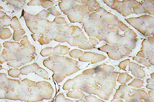 VEGFA / VEGF Antibody - IHC of VEGF-A (R159) pAb in paraffin-embedded human skeletal muscle tissue.