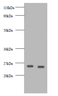 VEGFA / VEGF Antibody - Western blot of Vascular endothelial growth factor A antibody at 2 ug/ml. Lane 1: EC109 whole cell lysate. Lane 2: 293T whole cell lysate. Secondary: Goat polyclonal to rabbit IgG at 1:10000 dilution. Predicted band size: 26 kDa. Observed band size: 26 kDa.  This image was taken for the unconjugated form of this product. Other forms have not been tested.