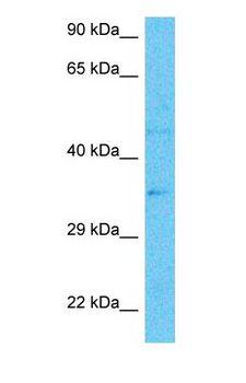 VEGFA / VEGF Antibody - Western blot of VEGFA Antibody with human Jurkat Whole Cell lysate.  This image was taken for the unconjugated form of this product. Other forms have not been tested.