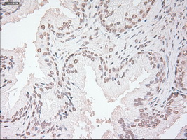 VEGFA / VEGF Antibody - IHC of paraffin-embedded prostate tissue using anti-VEGF mouse monoclonal antibody. (Dilution 1:50).