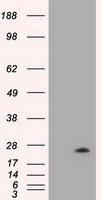 VEGFA / VEGF Antibody - HEK293T cells were transfected with the pCMV6-ENTRY control (Left lane) or pCMV6-ENTRY VEGF (Right lane) cDNA for 48 hrs and lysed. Equivalent amounts of cell lysates (5 ug per lane) were separated by SDS-PAGE and immunoblotted with anti-VEGF.