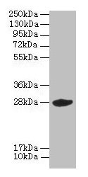 VEGFA / VEGF Antibody - Western blot All lanes: VEGF antibody at 6µg/ml + A431 whole cell lysate Secondary Goat polyclonal to rabbit IgG at 1/10000 dilution Predicted band size: 28, 26, 25, 23, 21, 18, 16, 41, 35, 44, 46, 43, 39 kDa Observed band size: 28 kDa