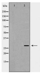 VEGFA / VEGF Antibody - Western blot of VEGF expression in A431 cells