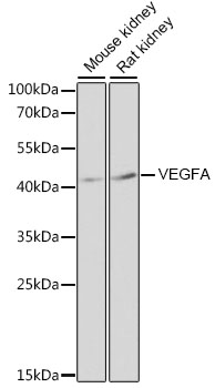 VEGFA / VEGF Antibody - Western blot analysis of extracts of various cell lines, using VEGFA antibody at 1:3000 dilution. The secondary antibody used was an HRP Goat Anti-Rabbit IgG (H+L) at 1:10000 dilution. Lysates were loaded 25ug per lane and 3% nonfat dry milk in TBST was used for blocking. An ECL Kit was used for detection and the exposure time was 30s.