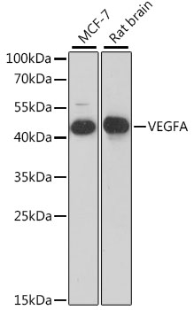 VEGFA / VEGF Antibody - Western blot analysis of extracts of various cell lines, using VEGFA antibody at 1:1000 dilution. The secondary antibody used was an HRP Goat Anti-Rabbit IgG (H+L) at 1:10000 dilution. Lysates were loaded 25ug per lane and 3% nonfat dry milk in TBST was used for blocking. An ECL Kit was used for detection and the exposure time was 90s.