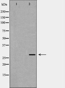 VEGFA / VEGF Antibody - Western blot analysis of VEGF expression in A431 cells. The lane on the left is treated with the antigen-specific peptide.