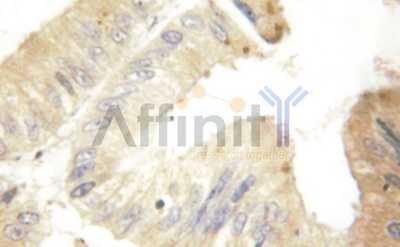 VEGFA / VEGF Antibody - 1/100 staining human colon  tissue by IHC-P. The sample was formaldehyde fixed and a heat mediated antigen retrieval step in citrate buffer was performed. The sample was then blocked and incubated with the antibody for 1.5 hours at 22°C. An HRP conjugated goat anti-rabbit antibody was used as the secondary antibody.