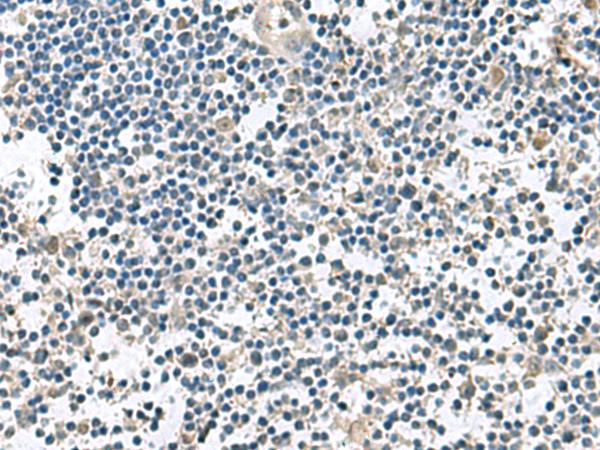VEGFA / VEGF Antibody - Immunohistochemistry of paraffin-embedded Human tonsil tissue  using VEGFA Polyclonal Antibody at dilution of 1:45(×200)