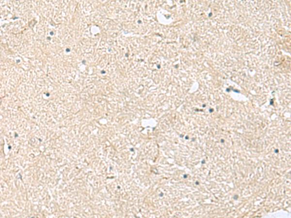 VEGFA / VEGF Antibody - Immunohistochemistry of paraffin-embedded Human brain tissue  using VEGFA Polyclonal Antibody at dilution of 1:60(×200)