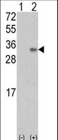 VEGFB Antibody - Western blot of VEGF2 (arrow) using rabbit polyclonal VEGF2 Antibody. 293 cell lysates (2 ug/lane) either nontransfected (Lane 1) or transiently transfected with the VEGF2 gene (Lane 2) (Origene Technologies).