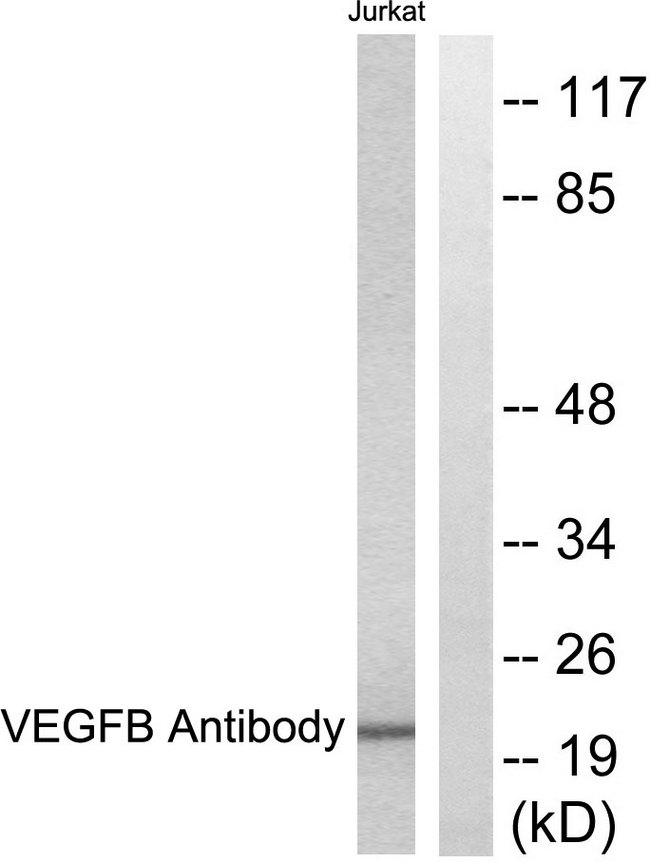 VEGFB Antibody - Western blot analysis of lysates from Jurkat cells, using VEGFB Antibody. The lane on the right is blocked with the synthesized peptide.
