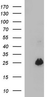 VEGFB Antibody - HEK293T cells were transfected with the pCMV6-ENTRY control (Left lane) or pCMV6-ENTRY VEGFB (Right lane) cDNA for 48 hrs and lysed. Equivalent amounts of cell lysates (5 ug per lane) were separated by SDS-PAGE and immunoblotted with anti-VEGFB.