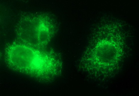 VEGFB Antibody - Anti-VEGFB mouse monoclonal antibody immunofluorescent staining of COS7 cells transiently transfected by pCMV6-ENTRY VEGFB.