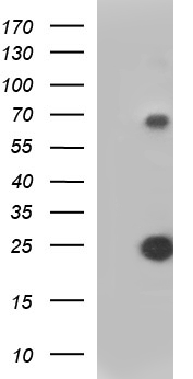 VEGFB Antibody - HEK293T cells were transfected with the pCMV6-ENTRY control (Left lane) or pCMV6-ENTRY VEGFB (Right lane) cDNA for 48 hrs and lysed. Equivalent amounts of cell lysates (5 ug per lane) were separated by SDS-PAGE and immunoblotted with anti-VEGFB.