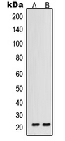 VEGFB Antibody - Western blot analysis of VEGFB expression in HT1080 (A); ACHN (B) whole cell lysates.