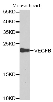 VEGFB Antibody - Western blot analysis of extracts of mouse heart cell lines, using VEGFB antibody.
