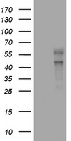 VEGFC Antibody - HEK293T cells were transfected with the pCMV6-ENTRY control (Left lane) or pCMV6-ENTRY VEGFC (Right lane) cDNA for 48 hrs and lysed. Equivalent amounts of cell lysates (5 ug per lane) were separated by SDS-PAGE and immunoblotted with anti-VEGFC.