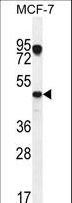 VEGFC Antibody - VEGF3 Antibody western blot of MCF-7 cell line lysates (35 ug/lane). The VEGF3 antibody detected the VEGF3 protein (arrow).