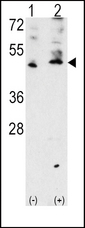 VEGFC Antibody - Western blot of VEGF3 Antibody polyclonal antibody(arrow). 293 cell lysates (2 ug/lane) either nontransfected (Lane 1) or transiently transfected with the VEGF3 gene (Lane 2) (Origene Technologies).