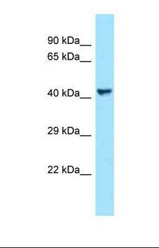 VEGFC Antibody - Western blot of Human NCI-H226. VEGFC antibody dilution 1.0 ug/ml.  This image was taken for the unconjugated form of this product. Other forms have not been tested.