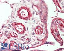 VEGFC Antibody - Anti-VEGFC antibody IHC staining of human placenta. Immunohistochemistry of formalin-fixed, paraffin-embedded tissue after heat-induced antigen retrieval. Antibody concentration 20 ug/ml. This image was taken for the unconjugated form of this product. Other forms have not been tested.