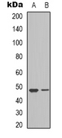 VEGFC Antibody - Western blot analysis of VEGFC expression in A549 (A); NIH3T3 (B) whole cell lysates.