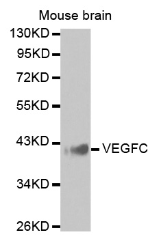 VEGFC Antibody - Western blot analysis of extracts of Mouse brain.