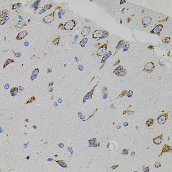 VEGFC Antibody - Immunohistochemistry of paraffin-embedded rat brain tissue.
