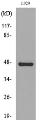 VEGFC Antibody - Western blot analysis of lysate from L929 cells, using VEGFC Antibody.
