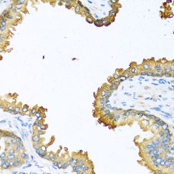VEGFC Antibody - Immunohistochemistry of paraffin-embedded human prostate using VEGFC antibody at dilution of 1:100 (40x lens).