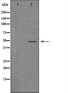 VEGFC Antibody - Western blot analysis of extracts of mouse brain tissue using VEGFC antibody. The lane on the left is treated with the antigen-specific peptide.