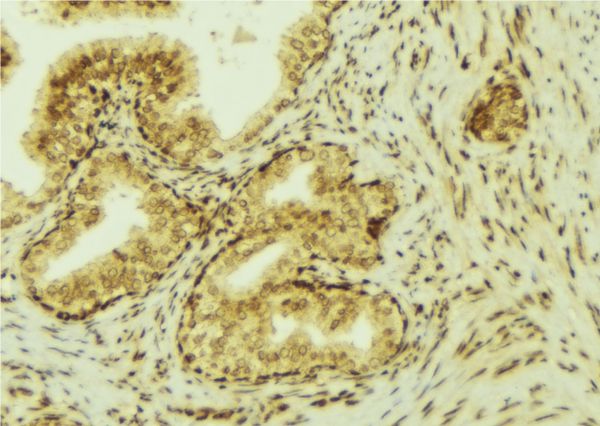 VEGFC Antibody - 1:100 staining mouse colon tissue by IHC-P. The sample was formaldehyde fixed and a heat mediated antigen retrieval step in citrate buffer was performed. The sample was then blocked and incubated with the antibody for 1.5 hours at 22°C. An HRP conjugated goat anti-rabbit antibody was used as the secondary.