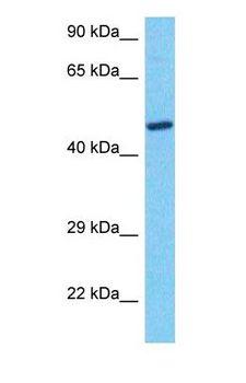 VEGFC Antibody - Western blot of VEGFC Antibody with human 786-0 Whole Cell lysate.  This image was taken for the unconjugated form of this product. Other forms have not been tested.