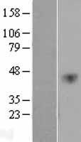 VEGFC Protein - Western validation with an anti-DDK antibody * L: Control HEK293 lysate R: Over-expression lysate
