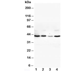 VEGFD Antibody - Western blot testing of VEGFD antibody and Lane 1: SW620; 2: COLO320; 3: 6T-CEM; 4: HT1080 cell lysate