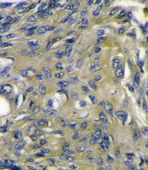 VEGFD Antibody - VEGFD (VEGF4) Antibody immunohistochemistry of formalin-fixed and paraffin-embedded mouse heart tissue followed by peroxidase-conjugated secondary antibody and DAB staining.This data demonstrates the use of VEGFD (VEGF4) Antibody for immunohistochemistry.