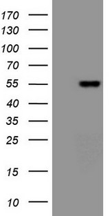 VEGFD Antibody - HEK293T cells were transfected with the pCMV6-ENTRY control. (Left lane) or pCMV6-ENTRY FIGF. (Right lane) cDNA for 48 hrs and lysed. Equivalent amounts of cell lysates. (5 ug per lane) were separated by SDS-PAGE and immunoblotted with anti-FIGF. (1:2000)