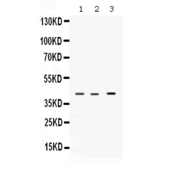 VEGFD Antibody - Western blot analysis of VEGFD expression in rat cardiac muscle extract (lane 1), HEPG2 whole cell lysates (lane 2) and A549 whole cell lysates (lane 3). VEGFD at 43 kD was detected using rabbit anti- VEGFD Antigen Affinity purified polyclonal antibody at 0.5 ug/mL. The blot was developed using chemiluminescence (ECL) method.