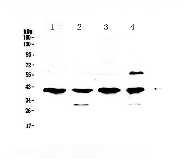 VEGFD Antibody - Western blot analysis of VEGFD using anti-VEGFD antibody. Electrophoresis was performed on a 5-20% SDS-PAGE gel at 70V (Stacking gel) / 90V (Resolving gel) for 2-3 hours. The sample well of each lane was loaded with 50ug of sample under reducing conditions. Lane 1: rat lung tissue lysates, Lane 2: rat brain tissue lysates, Lane 3: mouse lung tissue lysates, Lane 4: mouse brain tissue lysates. After Electrophoresis, proteins were transferred to a Nitrocellulose membrane at 150mA for 50-90 minutes. Blocked the membrane with 5% Non-fat Milk/ TBS for 1.5 hour at RT. The membrane was incubated with rabbit anti-VEGFD antigen affinity purified polyclonal antibody at 0.5 µg/mL overnight at 4°C, then washed with TBS-0.1% Tween 3 times with 5 minutes each and probed with a goat anti-rabbit IgG-HRP secondary antibody at a dilution of 1:10000 for 1.5 hour at RT. The signal is developed using an Enhanced Chemiluminescent detection (ECL) kit with Tanon 5200 system. A specific band was detected for VEGFD at approximately 40KD. The expected band size for VEGFD is at 40KD.