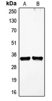 VEGFD Antibody - Western blot analysis of VEGFD expression in HDMEC (A); HEK293T (B) whole cell lysates.