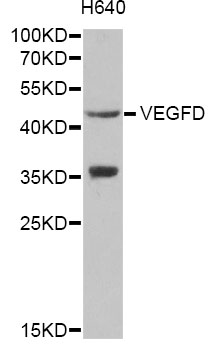 VEGFD Antibody - Western blot analysis of extracts of H640 cells, using VEGFD antibody at 1:1000 dilution. The secondary antibody used was an HRP Goat Anti-Rabbit IgG (H+L) at 1:10000 dilution. Lysates were loaded 25ug per lane and 3% nonfat dry milk in TBST was used for blocking.