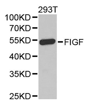 VEGFD Antibody - Western blot analysis of extracts of 293T cells, using VEGFD antibody at 1:1000 dilution. The secondary antibody used was an HRP Goat Anti-Rabbit IgG (H+L) at 1:10000 dilution. Lysates were loaded 25ug per lane and 3% nonfat dry milk in TBST was used for blocking.