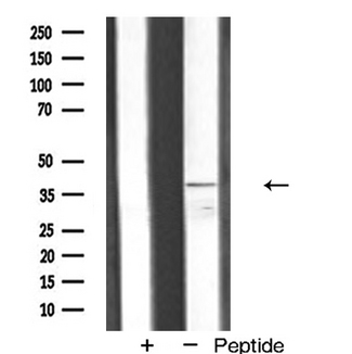 VEGFD Antibody - Western blot analysis of VEGFD expression in COS-7 cells