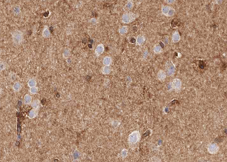 VEGFD Antibody - 1:100 staining human brain tissue by IHC-P. The tissue was formaldehyde fixed and a heat mediated antigen retrieval step in citrate buffer was performed. The tissue was then blocked and incubated with the antibody for 1.5 hours at 22°C. An HRP conjugated goat anti-rabbit antibody was used as the secondary.