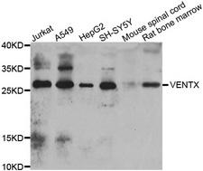 VENTX Antibody - Western blot analysis of extracts of various cell lines.
