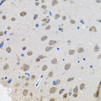 VEPH1 Antibody - Immunohistochemistry of paraffin-embedded rat brain tissue.