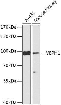 VEPH1 Antibody - Western blot analysis of extracts of various cell lines using VEPH1 Polyclonal Antibody at dilution of 1:1000.