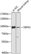 VEPH1 Antibody - Western blot analysis of extracts of various cell lines using VEPH1 Polyclonal Antibody at dilution of 1:1000.