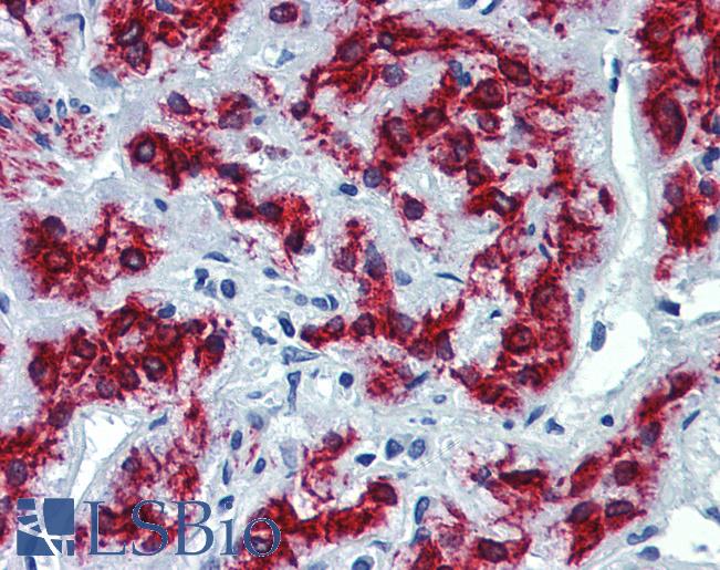 VEZF1 Antibody - Anti-VEZF1 antibody IHC of human adrenal. Immunohistochemistry of formalin-fixed, paraffin-embedded tissue after heat-induced antigen retrieval. Antibody concentration 5 ug/ml.  This image was taken for the unconjugated form of this product. Other forms have not been tested.